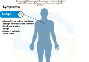 Causes of Chronic Pharyngitis: What You Need to Know!