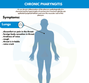 Read more about the article Causes of Chronic Pharyngitis: What You Need to Know!