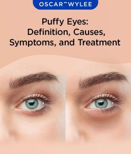 Read more about the article It’s Not Puffy Eyes, It’s Aging Eyes!